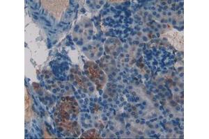 Used in DAB staining on fromalin fixed paraffin- embedded kidney tissue (Frataxin antibody  (AA 41-207))