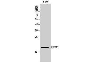 Western Blotting (WB) image for anti-Glucuronidase, beta Pseudogene 1 (GUSBP1) (Internal Region) antibody (ABIN6283061) (GUSBP1 antibody  (Internal Region))