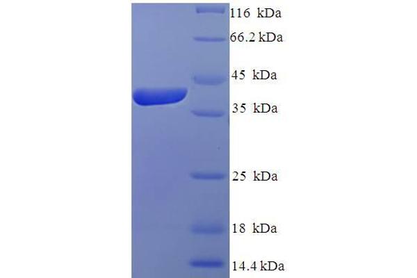 IZUMO4 Protein (AA 16-214, Isoform 2) (His-SUMO Tag)