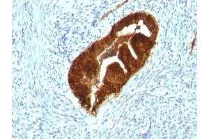 Immunohistochemistry (Formalin-fixed Paraffin-embedded Sections) (IHC (fp)) image for anti-Keratin 19 (KRT19) antibody (ABIN3025850)