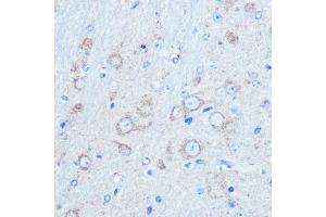 Immunohistochemistry of paraffin-embedded mouse brain using LC3B Rabbit pAb (ABIN6129924 and ABIN6143474) at dilution of 1:100 (40x lens). (LC3B antibody)