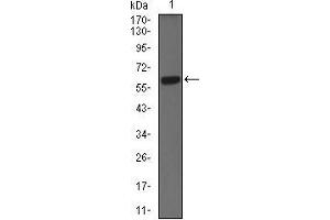 Western Blotting (WB) image for anti-Keratin 5 (KRT5) (AA 316-590) antibody (ABIN1724789)