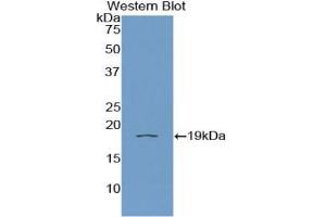 Detection of Recombinant IL11Ra, Human using Polyclonal Antibody to Interleukin 11 Receptor Alpha (IL11Ra) (IL11RA antibody  (AA 59-220))