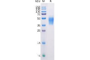 Human B7-H6 Protein, His Tag on SDS-PAGE under reducing condition. (B7-H6 Protein (AA 25-262) (His tag))