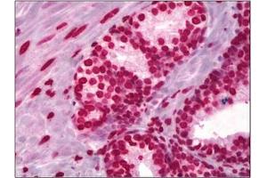 Immunohistochemical analysis using Histone H3 antibody at 5 µg/ml on Human Prostate tissue (Formalin-fixed, Paraffin-embedded). (Histone 3 antibody)