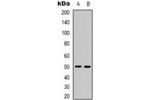 Western blot analysis of PPP4R2 expression in Hela (A), COS7 (B) whole cell lysates. (PPP4R2 antibody)