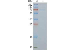 Human EN-Nanodisc, Flag Tag on SDS-PAGE (ENTPD2 Protein)