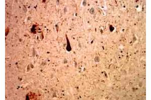 MCA-Ubi-1 staining of cerebral cortex of an Alzheimer patient. (Ubiquitin antibody)