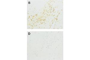 Immunohistochemistry image of acrolein adduct staining in paraffn sections of human atherosclerotic tissue. (ACR-Modified KL antibody)