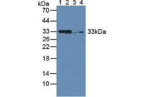 Figure. (CBR1 antibody  (AA 66-271))