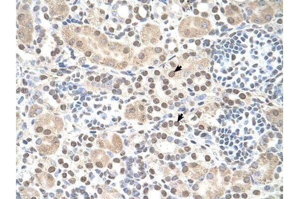 ST8SIA2 antibody  (C-Term)