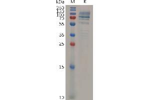 Mouse CD138 Protein, hFc Tag on SDS-PAGE under reducing condition. (Syndecan 1 Protein (SDC1) (AA 23-254) (Fc Tag))