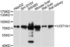 Western blot analysis of extracts of various cell lines, using UGT1A1 antibody (ABIN1875274) at 1:1000 dilution. (UGT1A1 antibody)