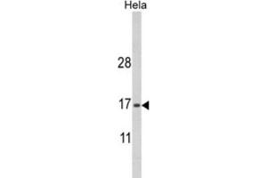 Western Blotting (WB) image for anti-MpV17 Mitochondrial Inner Membrane Protein (MPV17) antibody (ABIN3003896) (MPV17 antibody)