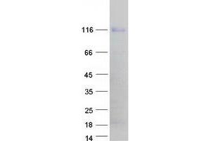 Validation with Western Blot (NFAT1 Protein (Transcript Variant D) (Myc-DYKDDDDK Tag))