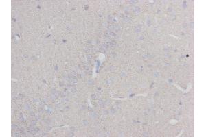 Immunohistochemistry (IHC) image for anti-Tubulin, beta 3 (TUBB3) (N-Term) antibody (ABIN1854950) (TUBB3 antibody  (N-Term))