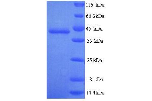 GNAO1 Protein (AA 2-354) (His tag)