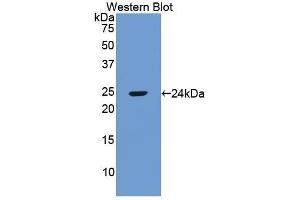 Western blot analysis of the recombinant protein. (RBP3 antibody  (AA 422-601))