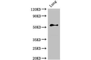 Western Blot Positive WB detected in: Rat lung tissue All lanes: BMPR1B antibody at 2. (BMPR1B antibody  (AA 14-126))