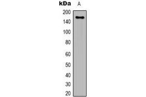 Western blot analysis of EGFR expression in Hela (A) whole cell lysates. (EGFR antibody)