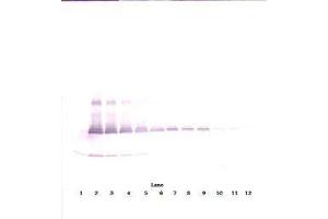 Image no. 3 for anti-Interleukin 17A (IL17A) antibody (ABIN465353) (Interleukin 17a antibody)