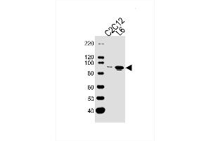 Lane 1: Mouse C2C12 Cell Lysates, Lane 2: Rat L6 Cell Lysates, probed with Musk (1429CT456. (MUSK antibody)