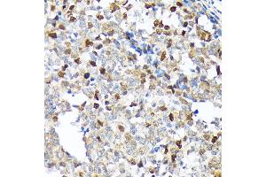 Immunohistochemistry of paraffin-embedded human appendix using KIFC1 Rabbit mAb (ABIN1680485, ABIN3015039, ABIN3015040 and ABIN7101305) at dilution of 1:100 (40x lens). (KIFC1 antibody)