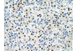 EXOSC4 antibody was used for immunohistochemistry at a concentration of 4-8 ug/ml to stain Hepatocytes (arrows) in Human Liver. (EXOSC4 antibody  (N-Term))