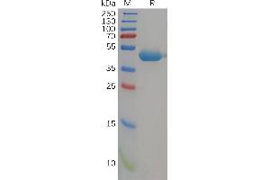 Human CD112 Protein, His Tag on SDS-PAGE under reducing condition. (PVRL2 Protein (AA 32-360) (His tag))