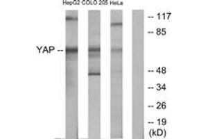 Western Blotting (WB) image for anti-Yes-Associated Protein 1 (YAP1) (AA 281-330) antibody (ABIN2889486) (YAP1 antibody  (AA 281-330))