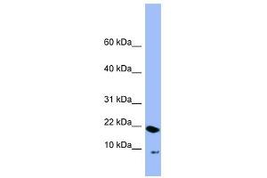 PIN4 antibody used at 1 ug/ml to detect target protein. (PIN4 antibody  (N-Term))