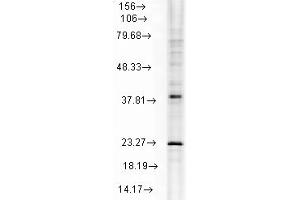 Western Blotting (WB) image for anti-Heat Shock 22kDa Protein 8 (HSPB8) antibody (ABIN6656215)