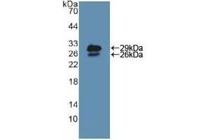 Figure. (NUP85 antibody  (AA 418-653))