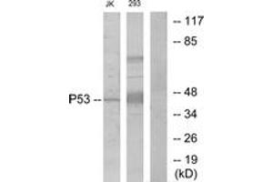 Western Blotting (WB) image for anti-Tumor Protein P53 (TP53) (AA 1-50) antibody (ABIN2889047) (p53 antibody  (AA 1-50))