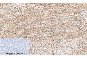 Immunohistochemical analysis of paraffin-embedded human uterus tissue. (CREB1 antibody  (pSer133))