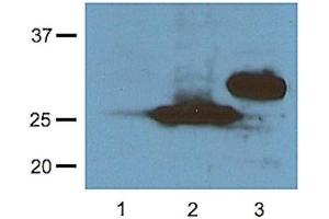 1:1000 (1 ug/ml) antibody dilution probed against HEK 293 cells transfected with RFP vector; unstransfected control (1), transfected with TurboRFP (2) and transfected with dsRed (3) (RFP antibody  (N-Term))