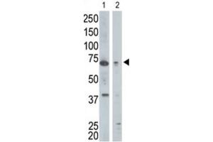 Western Blotting (WB) image for anti-Golgi-Associated, gamma Adaptin Ear Containing, ARF Binding Protein 1 (GGA1) antibody (ABIN3001508) (GGA1 antibody)