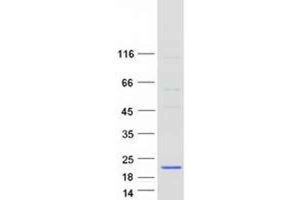 NDUFB6 Protein (Transcript Variant 1) (Myc-DYKDDDDK Tag)