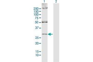 Lane 1: DKK1 transfected lysate ( 28. (DKK1 293T Cell Transient Overexpression Lysate(Denatured))