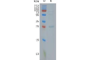 SDS-PAGE (SDS) image for CLDN18.2 protein (ABIN7491593)