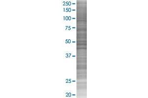 TRPA1 transfected lysate. (TRPA1 293T Cell Transient Overexpression Lysate(Denatured))