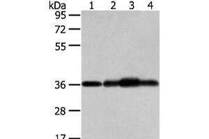 Western Blot analysis of Mouse brain tissue, hepg2, 293T and 231 cell using STX12 Polyclonal Antibody at dilution of 1/800 (Syntaxin 12 antibody)