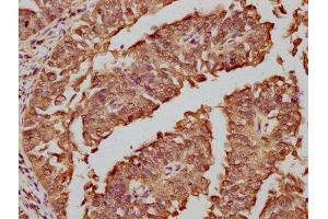 Immunohistochemistry (IHC) image for anti-c-Fos (c-Fos) antibody (ABIN7127496)