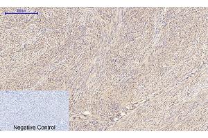 Immunohistochemical analysis of paraffin-embedded human uterus tissue. (IRS1 antibody)