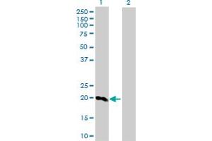 Western Blot analysis of SFTPC expression in transfected 293T cell line by SFTPC MaxPab rabbit polyclonal antibody. (Surfactant Protein C antibody  (AA 1-197))