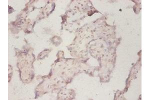 Immunohistochemistry of paraffin-embedded human placenta tissue using ABIN7142723 at dilution of 1:50 (RPLP1 antibody  (AA 2-114))