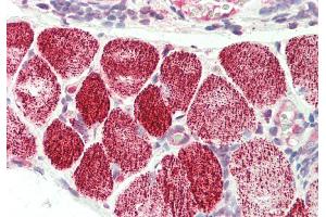 Rabbit Anti-CRLS1 antibody  Formalin Fixed Paraffin Embedded Tissue: Human Tonsil, Skeletal Myocytes Primary antibody Concentration: 1:100 Secondary Antibody: Donkey anti-Rabbit-Cy3 Secondary Antibody Concentration: 1:200 Magnification: 20x Exposure Time: 0. (CRLS1 antibody  (Middle Region))