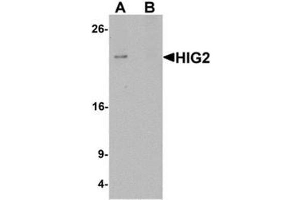 HILPDA antibody  (C-Term)