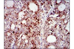 Immunohistochemistry (IHC) image for anti-Phosphoinositide 3 Kinase, p85 alpha (PI3K p85a) (AA 159-388) antibody (ABIN1098111)