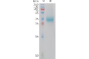 APOA2 Protein (AA 19-100) (Fc Tag)